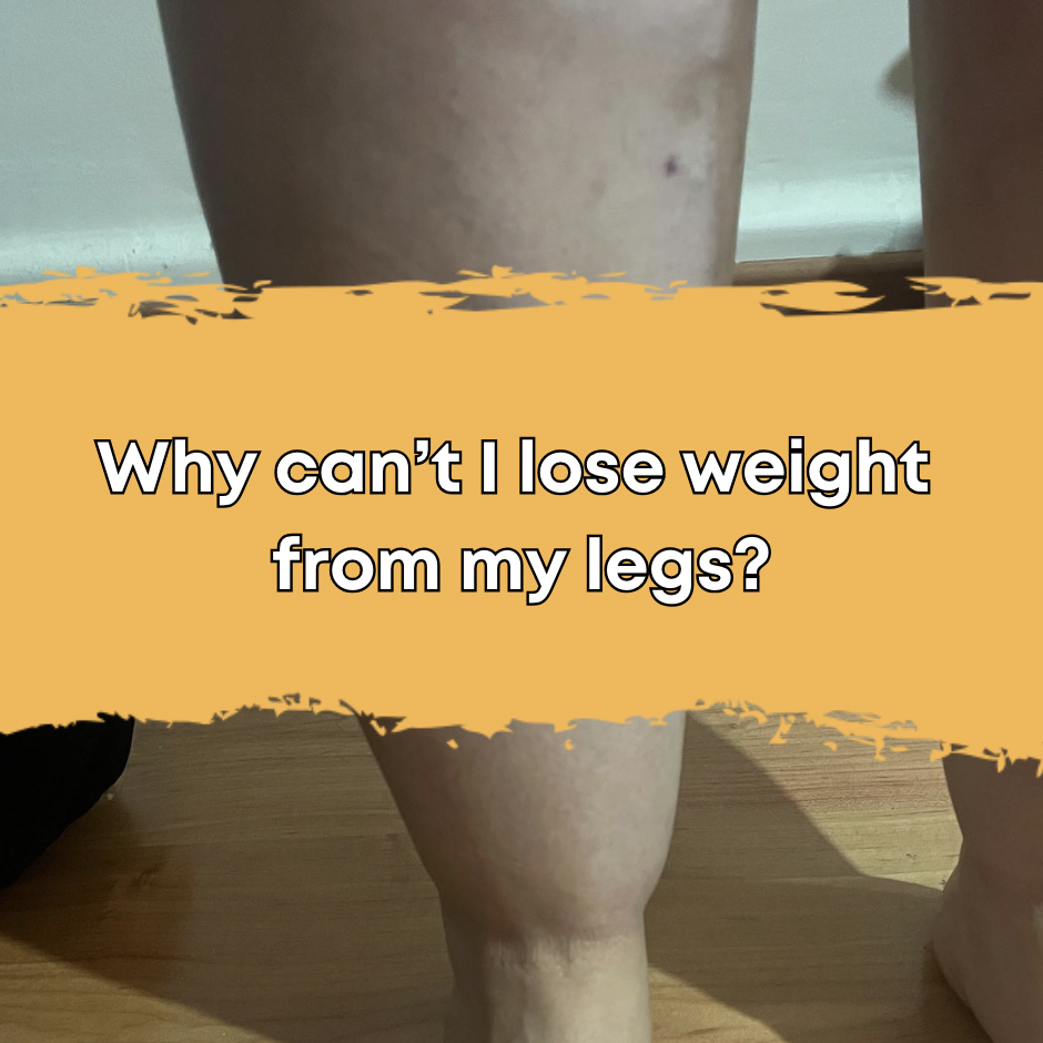 Why can’t I lose weight from my legs?