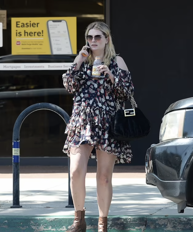 Mischa Barton Lipedema