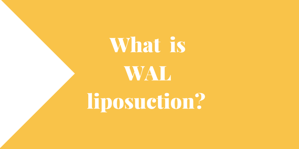 What is WAL liposuction?