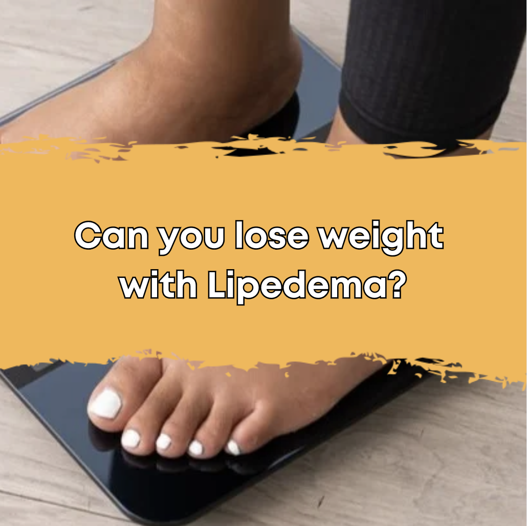 Can you lose weight with Lipedema?