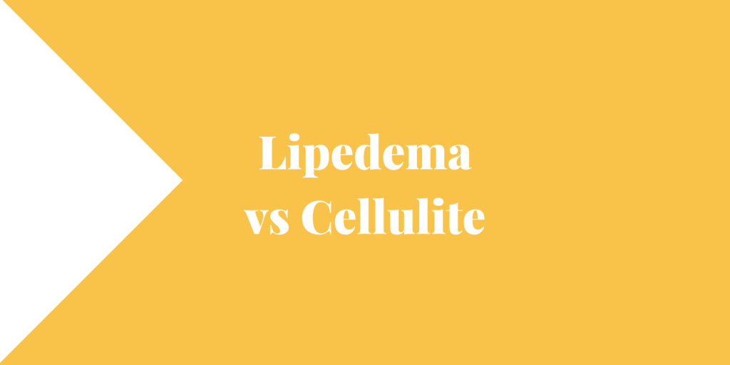 Lipedema vs Cellulite