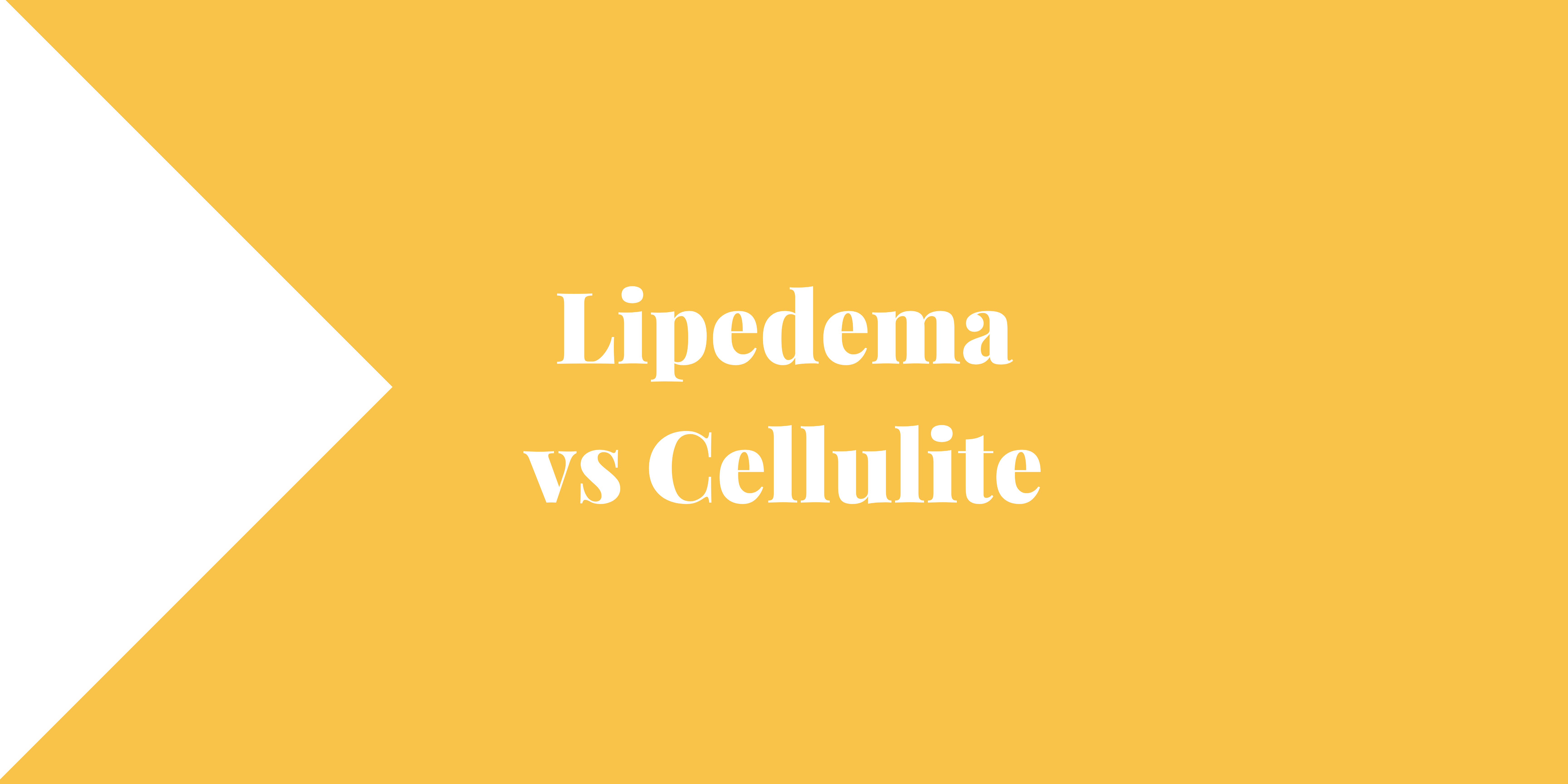Lipedema vs Cellulite, Lipedema Stages and More