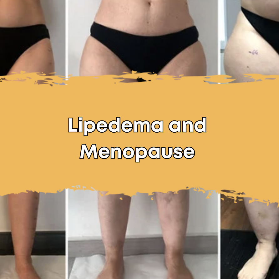 Lipedema and Menopause