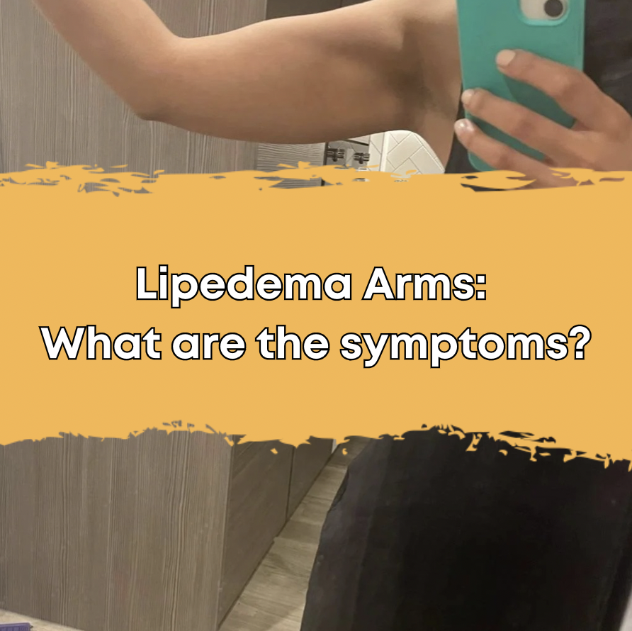 Lipedema Arms: What are the symptoms?