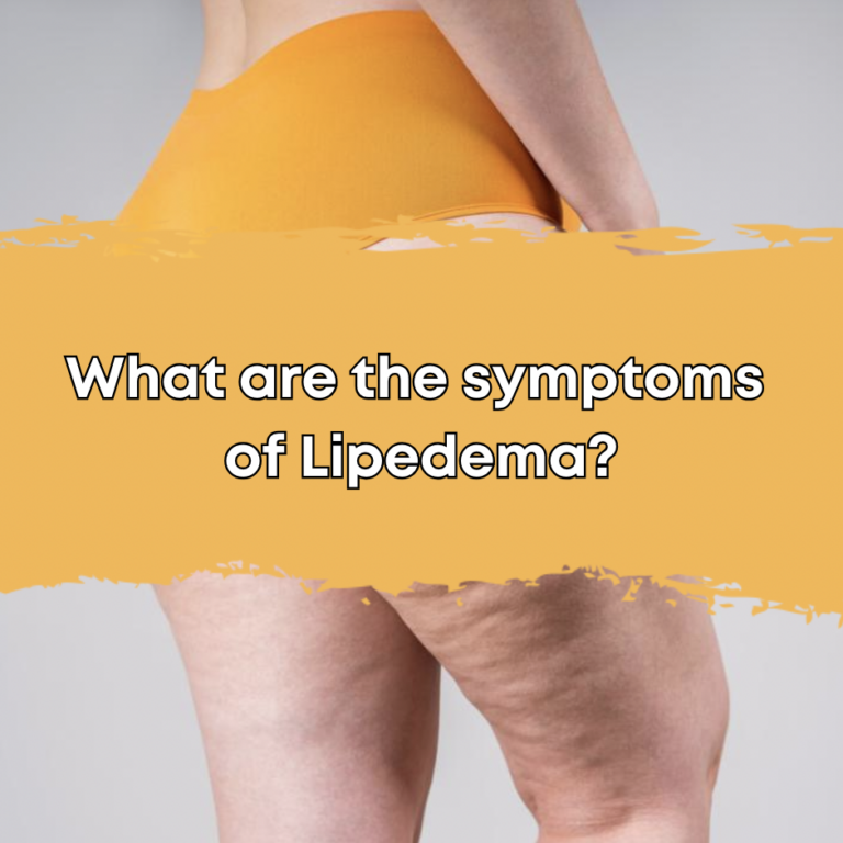 What are the symptoms of Lipedema?