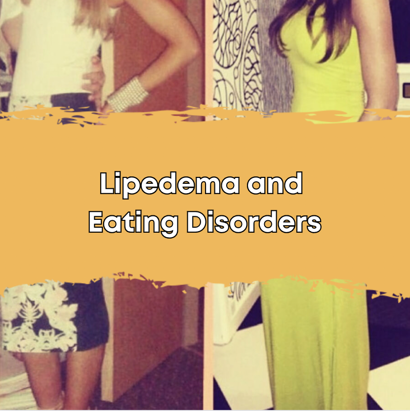 Lipedema and Eating Disorders