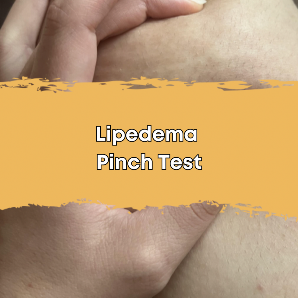 Lipedema Pinch Test