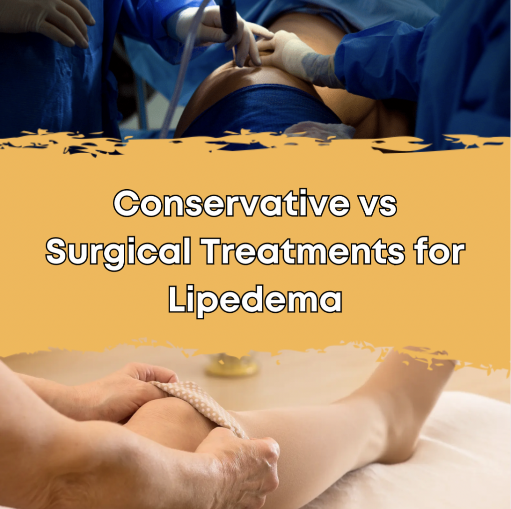 Conservative vs Surgical Treatments for Lipedema