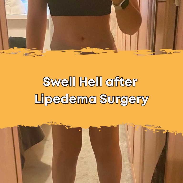 Thumbnail - Swell Hell after Lipedema Surgery