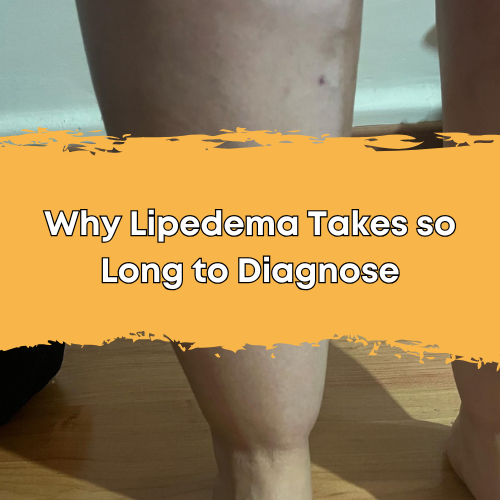 Why Lipedema Takes So Long To Diagnose